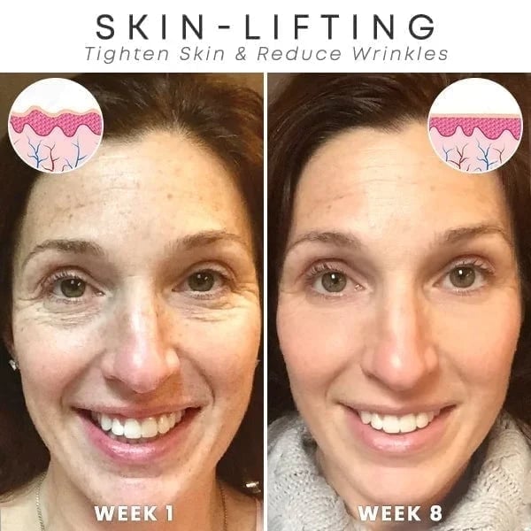 đ„Botox Face Serum