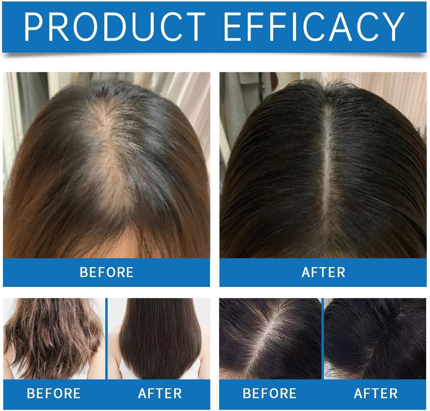 ☘️Head hair growth essence-the roller design is closer to the scalp