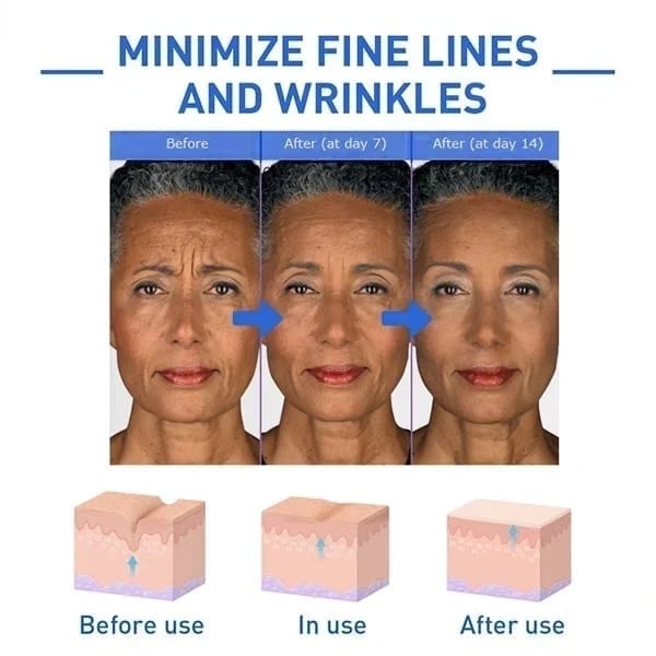 đ„Botox Face Serum