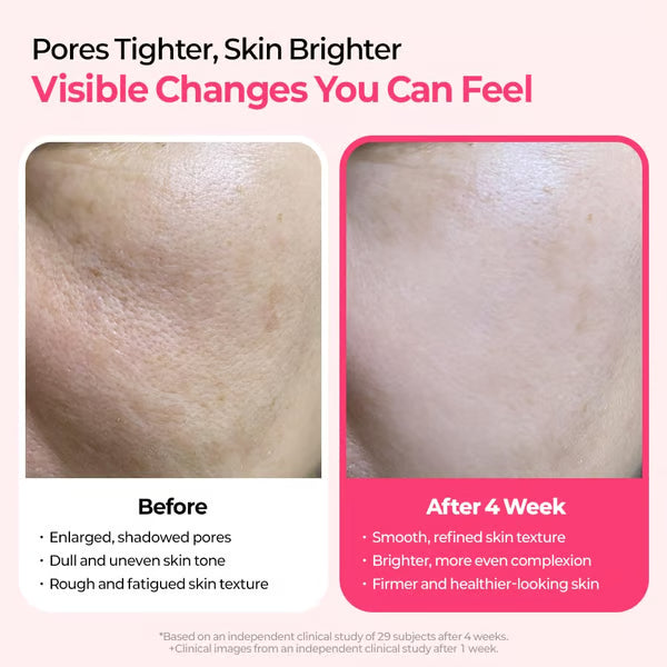 Pore & Spot Care Duo – Instantly Tightens Pores & Fades Dark Spots