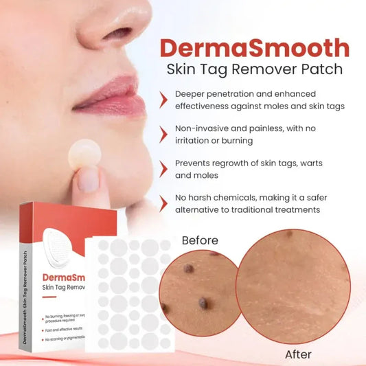 Skin Tag Removal Patch
