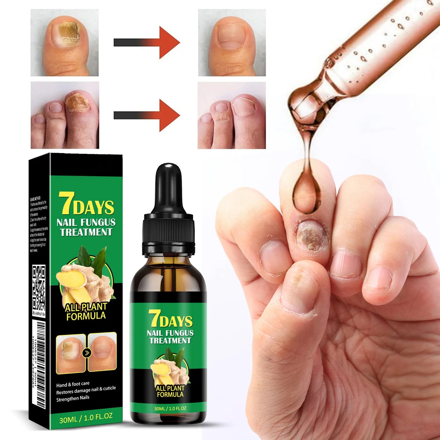 Ginger-Based Herbal Lotion for Nails & Skin — Works in Days, Naturally Safe