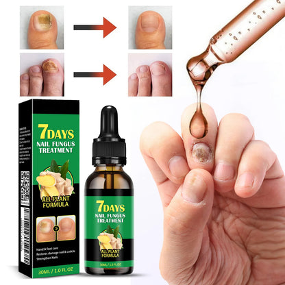 Ginger-Based Herbal Lotion for Nails & Skin — Works in Days, Naturally Safe