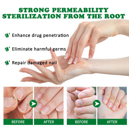 Ginger-Based Herbal Lotion for Nails & Skin — Works in Days, Naturally Safe
