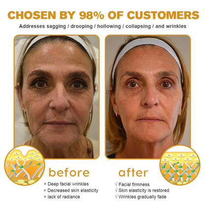 👨‍⚕️ LAST DAY 49% OFF✅  Botox Bee Venom Wrinkle Removal Cream