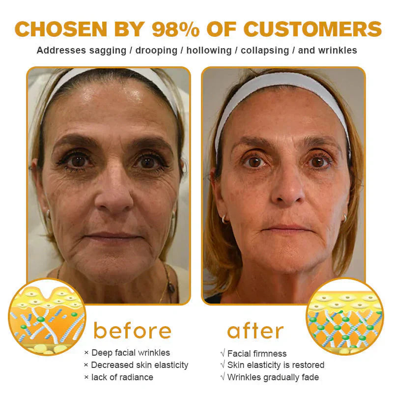 👨‍⚕️ Made and Shipped from US✅  Botox Bee Venom Wrinkle Removal Cream