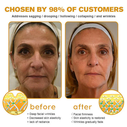 👨‍⚕️ Made and Shipped from US✅  Botox Bee Venom Wrinkle Removal Cream