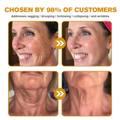 👨‍⚕️ Made and Shipped from US✅  Botox Bee Venom Wrinkle Removal Cream