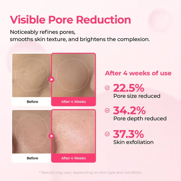 Pore & Spot Care Duo – Instantly Tightens Pores & Fades Dark Spots
