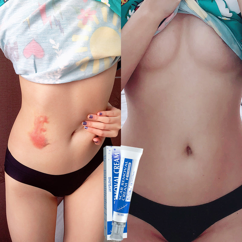 Natural Scar Cream – Fast Results, Safe for All Skin