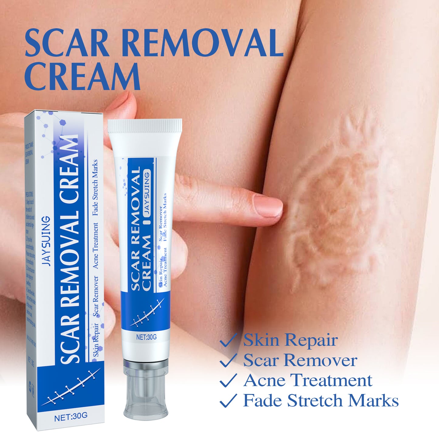 Natural Scar Cream – Fast Results, Safe for All Skin