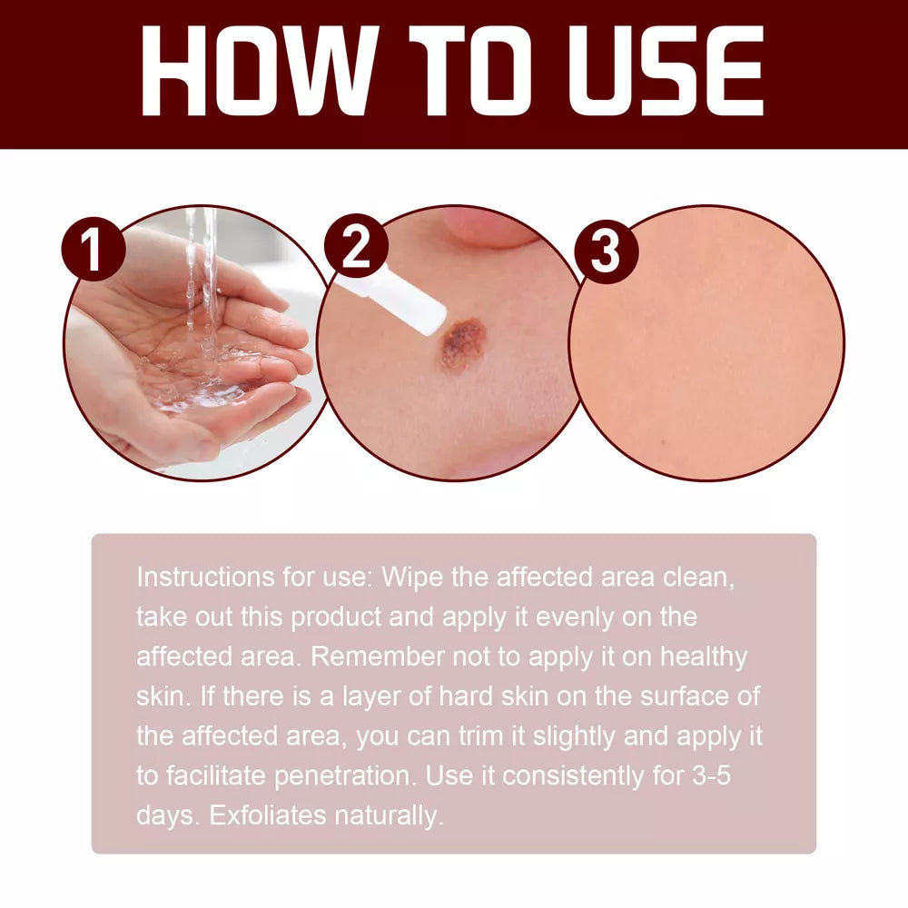 Tags & Moles Remover – Quick & Scar-Free Solution for Skin Tags & Warts