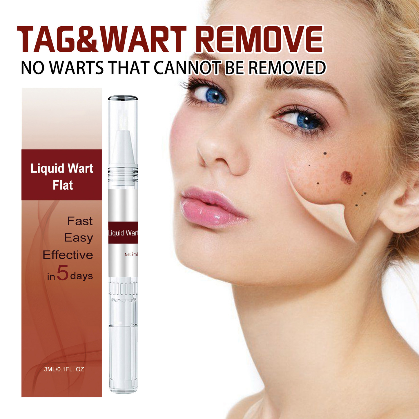 Tags & Moles Remover – Quick & Scar-Free Solution for Skin Tags & Warts