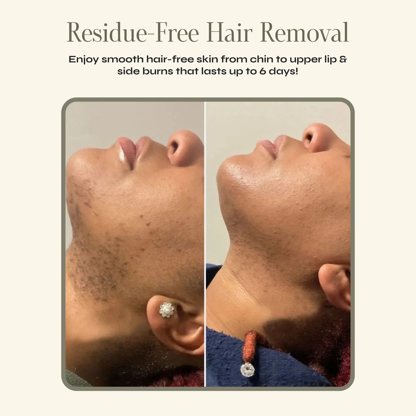 Facial Hair Removal Cream & Calming Serum
