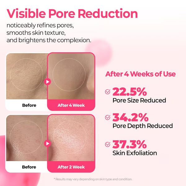 Pore & Spot Care Duo – Instantly Tightens Pores & Fades Dark Spots