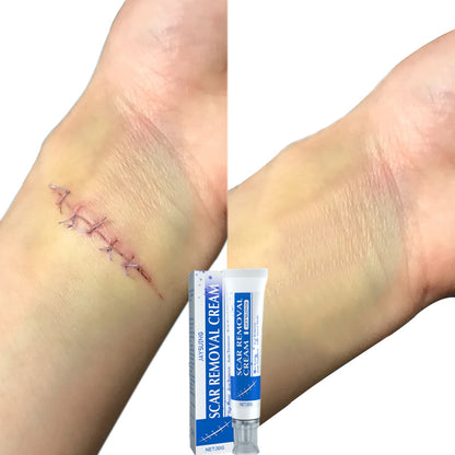 Natural Scar Cream – Fast Results, Safe for All Skin